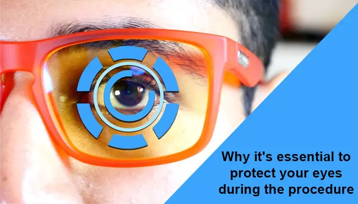 Why it's essential to protect your eyes during the procedure 