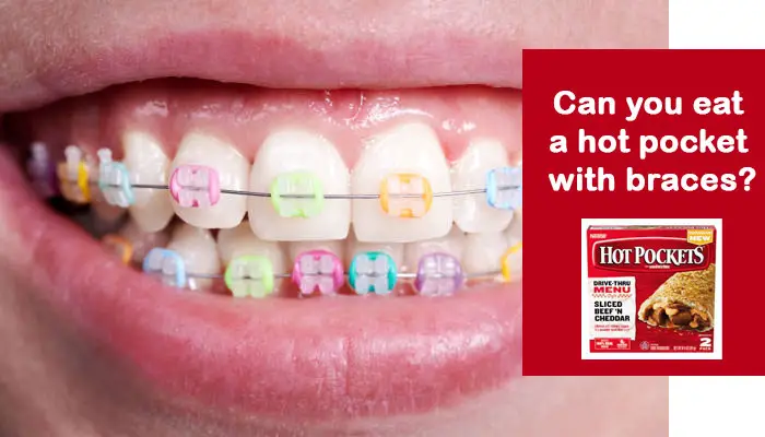 Can you eat a hot pocket with braces?